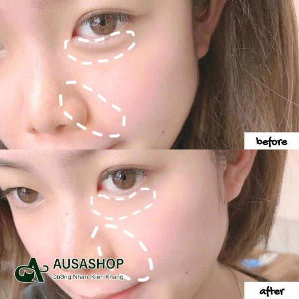 Khách hàng tại Nhật Bản cảm nhận về Collagen nước DHC