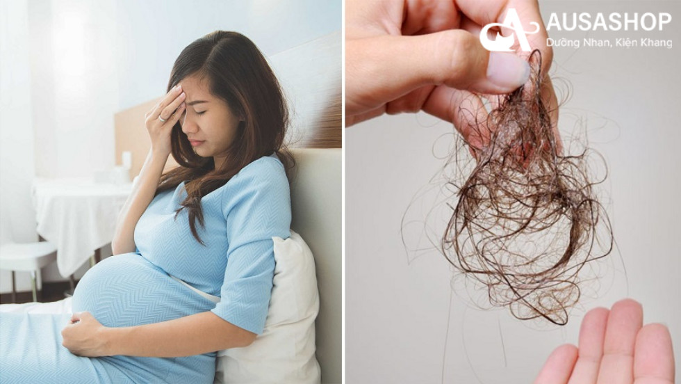 tại sao tóc rụng khi mang thai